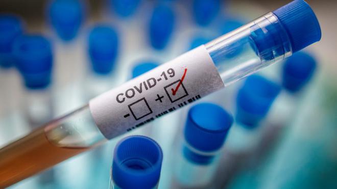 Tunisie – Coronavirus : La barre des décès dépasse les 17 mille, plusieurs établissements hospitaliers confrontés à une pénurie d’oxygène