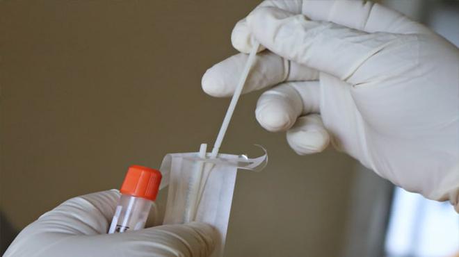 Covid-19. Les tests PCR et antigéniques ne seront plus gratuits dès le 15 octobre