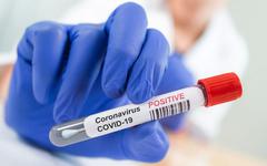 Tunisie/ Coronavirus : Evolution de la situation épidémique pendant la semaine du 09 au 15 Mai