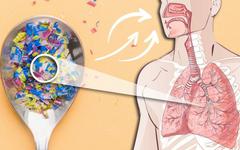 Étude : de nombreux microplastiques retrouvés dans les poumons humains