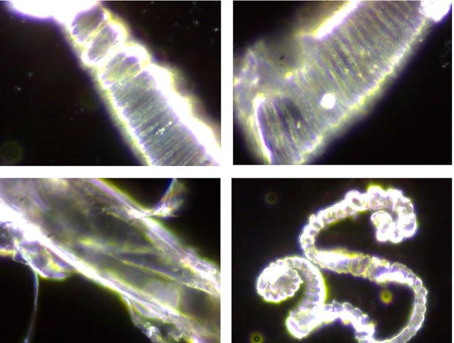 La Criminelle Arnaque du Covid-19: Des composés métalliques toxiques trouvés dans tous les échantillons de vaccin COVID