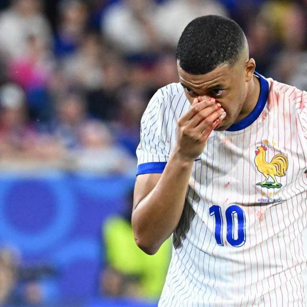 Euro 2024 - Bleus - Euro 2024 : Kylian Mbappé sérieusement touché au nez après un gros choc lors de France-Autriche