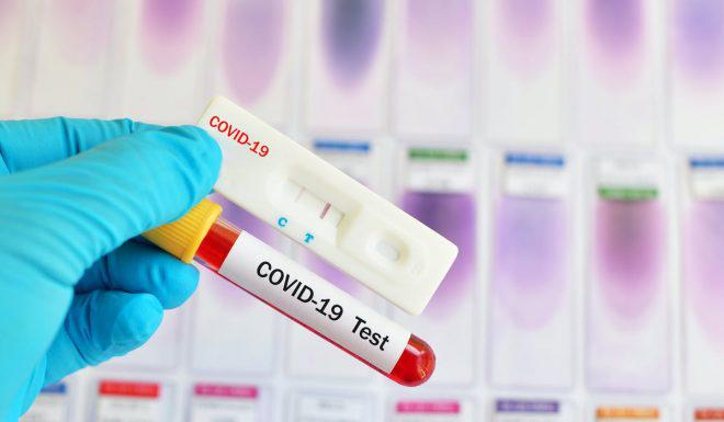 La Tunisie dépasse le un million de tests RT-PCR pour dépister le Coronavirus, tendance baissière des courbes