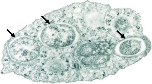 Une « pandémie » touchant les arthropodes causée par une bactérie