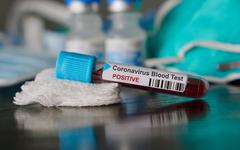 Tunisie – Coronavirus : La courbe des décès continue son ascension et enchaîne les records