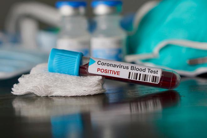 Tunisie – Coronavirus : La courbe des décès continue son ascension et enchaîne les records